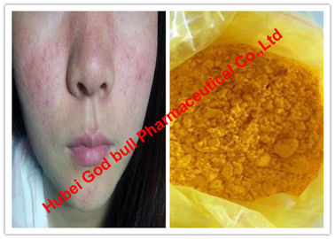 China Pós esteroides crus da cor amarela/Isotretinoin para cânceres de pele, CAS 4759-48-2 fornecedor