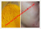 Pós esteroides crus da cor amarela/Isotretinoin para cânceres de pele, CAS 4759-48-2 fornecedor